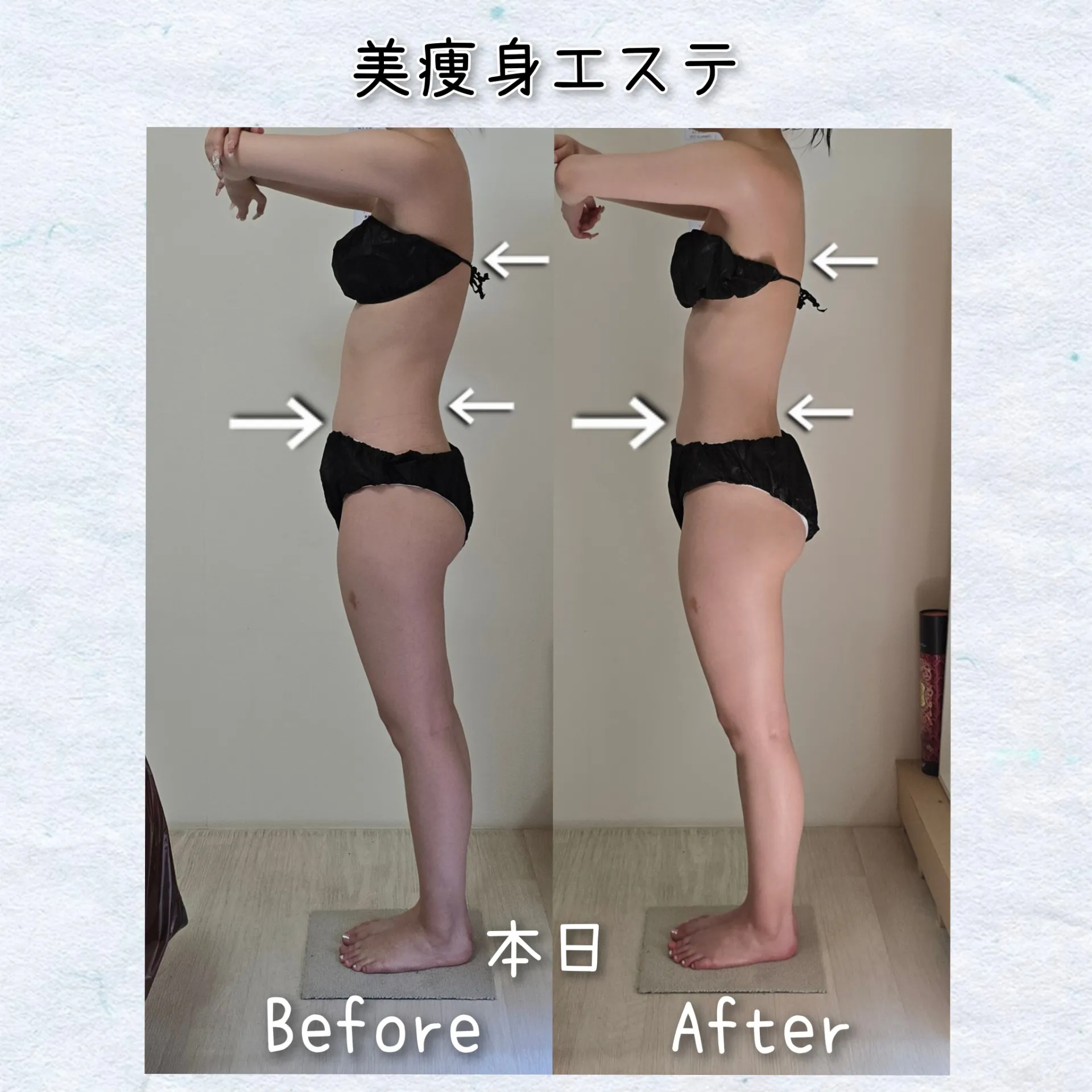 姿勢改善 【茨城県古河市エステサロン】