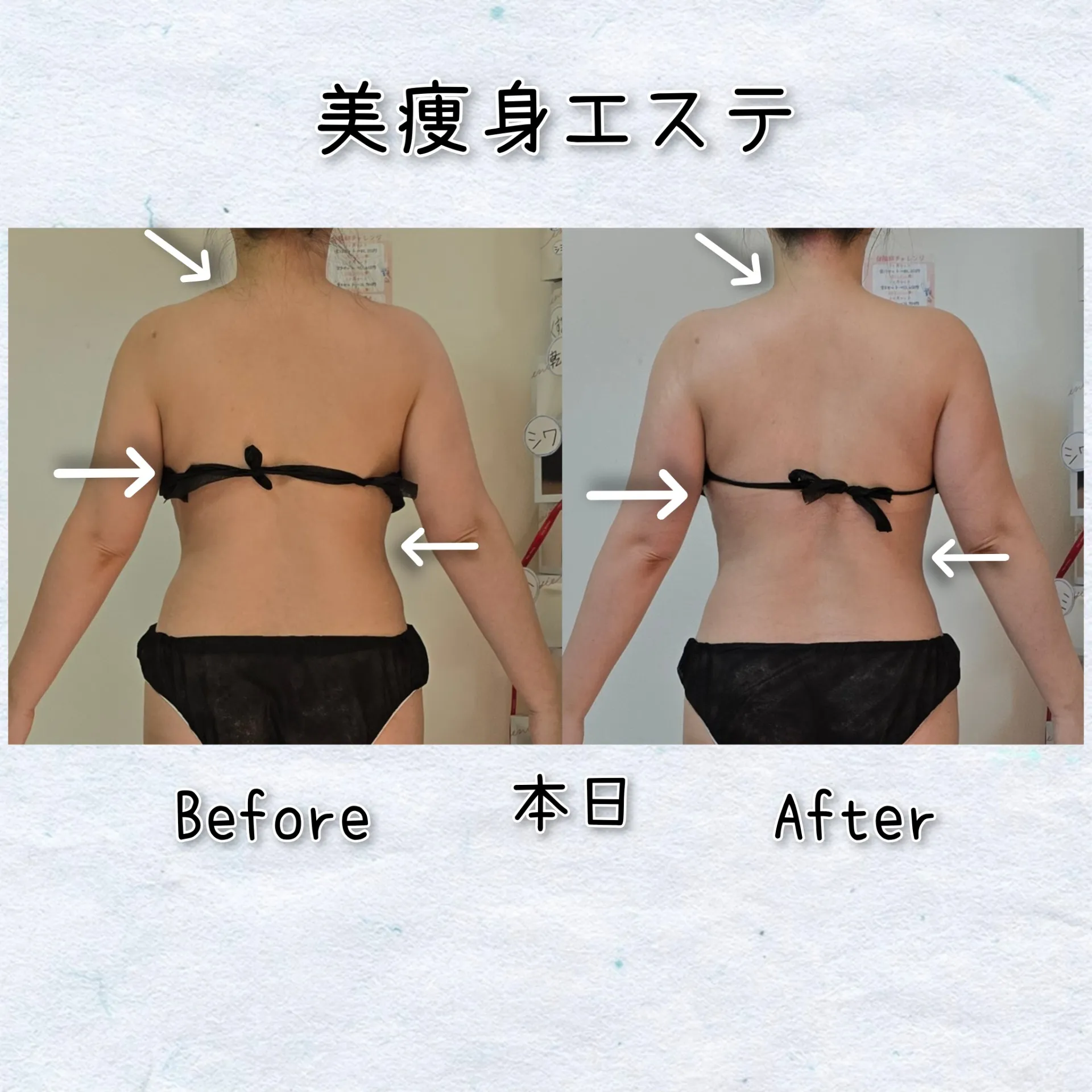 ハミ肉どこ行った?!